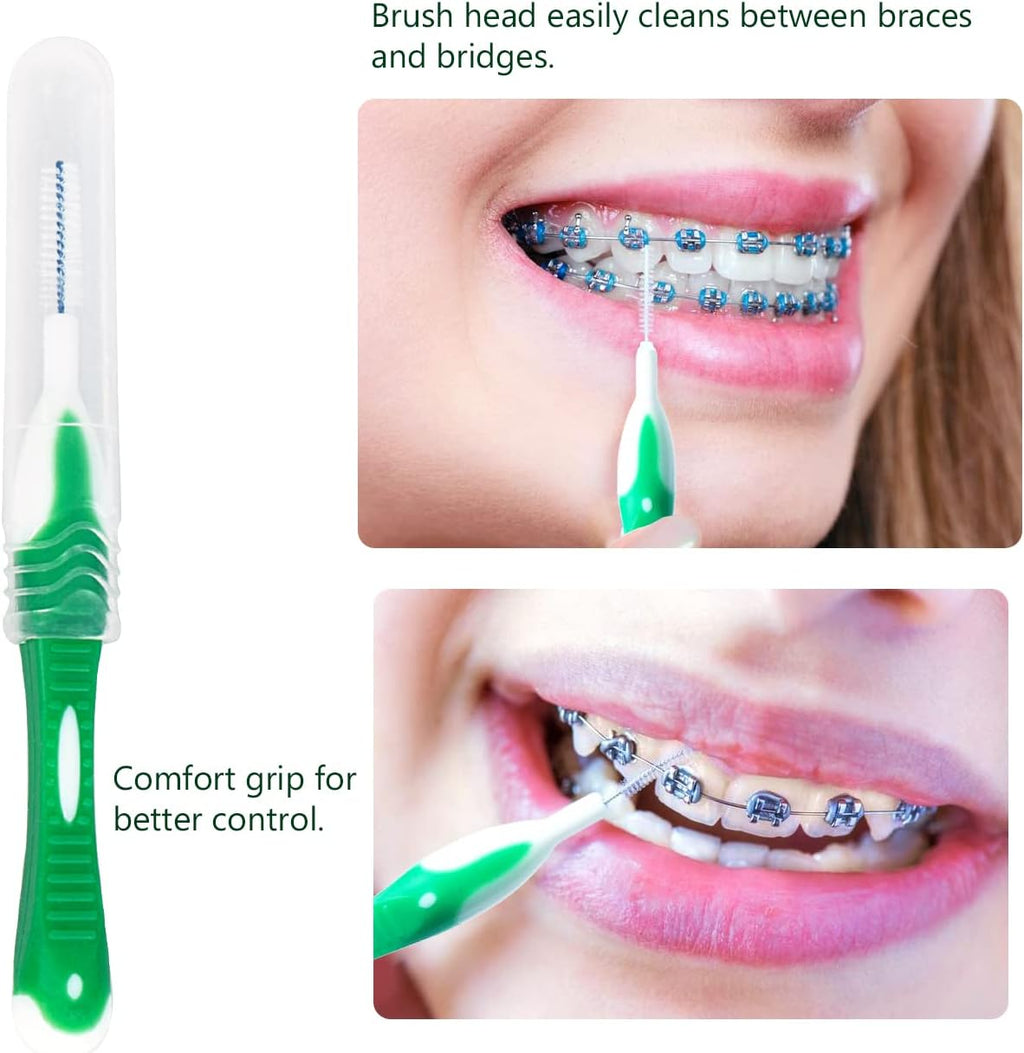 Uouovo Portable Orthodontic Oral Care Kit for Braces -2 Orthodontic Care Set - Dental Braces Kit, Interdental Brush Dental Wax Dental Floss Toothbrush Cleaning Kit(Purple & Blue) (Red_Green)